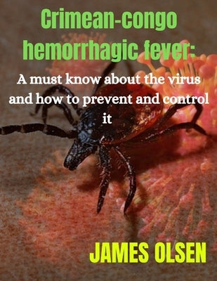 Crimean-congo hemorrhagic fever: A must know about the virus and how to prevent it by Olsen, James