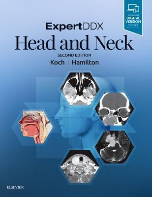 Expertddx: Head and Neck by Koch, Bernadette L.
