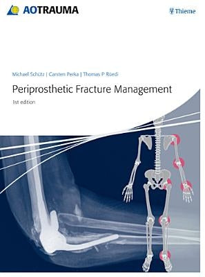 Periprosthetic Fracture Management by Schütz, Michael