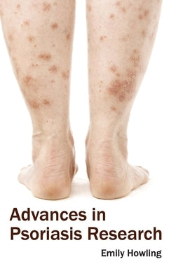 Advances in Psoriasis Research by Howling, Emily