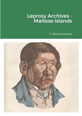 Leprosy Archives - Maltese Islands by Savona-Ventura, Charles