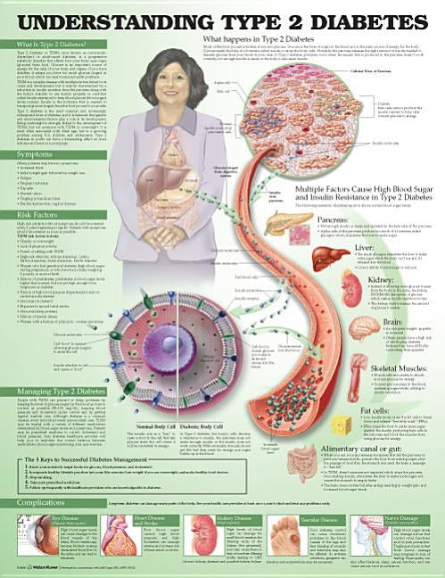 Understanding Type 2 Diabetes Anatomical Chart by Anatomical Chart Company