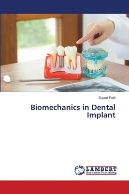 Biomechanics in Dental Implant by Patil, Sujeet