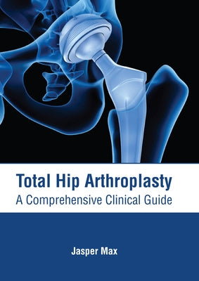 Total Hip Arthroplasty: A Comprehensive Clinical Guide by Max, Jasper