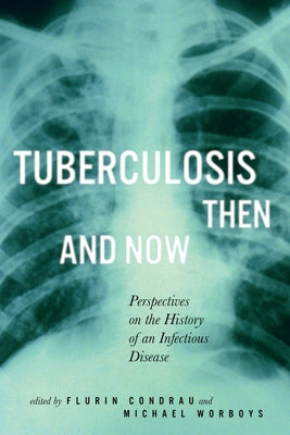 Tuberculosis Then and Now: Perspectives on the History of an Infectious Disease Volume 36 by Condrau, Flurin