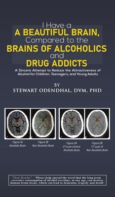 I Have a Beautiful Brain, Compared to the Brains of Alcoholics and Drug Addicts by Odendhal, DVM