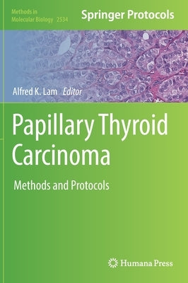 Papillary Thyroid Carcinoma: Methods and Protocols by Lam, Alfred K.