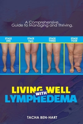 Living Well with Lymphedema: A Comprehensive Guide to Managing and Thriving by Ben-Hart, Tacha