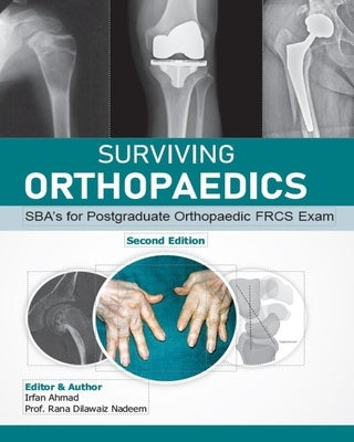 Surviving Orthopaedics: SBA's for Postgraduate Orthopaedic FRCS and Fellowship Exams (B&W edition) by Nadeem, Rana Dilawaiz