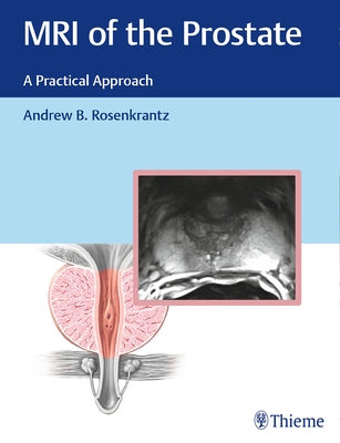 MRI of the Prostate: A Practical Approach by Rosenkrantz, Andrew