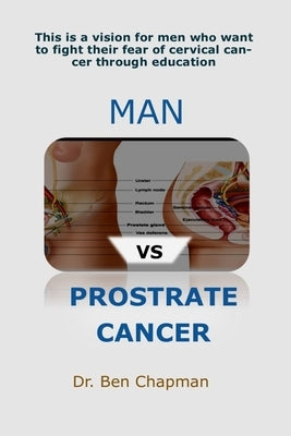 MAN Vs PROSTRATE CANCER: 100% Ageing Secret by Chapman, Ben