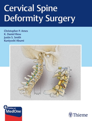 Cervical Spine Deformity Surgery by Ames, Christopher P.