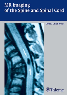 MR Imaging of the Spine and Spinal Cord by Uhlenbrock, Detlev