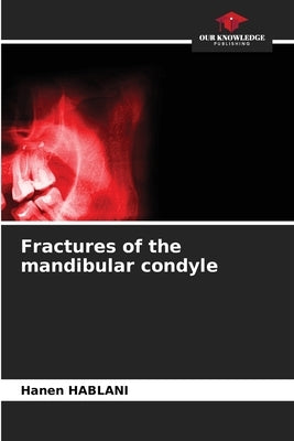 Fractures of the mandibular condyle by Hablani, Hanen