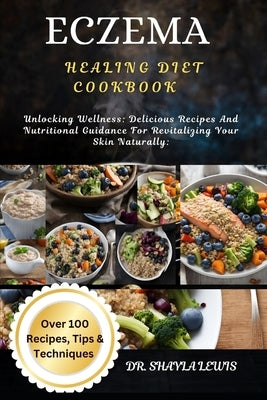 Eczema Healing Diet Cookbook: Unlocking Wellness: Delicious Recipes And Nutritional Guidance For Revitalizing Your Skin Naturally: by Lewis, Shayla