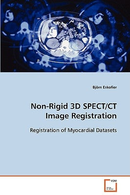Non-Rigid 3D SPECT/CT Image Registration by Eskofier, Björn