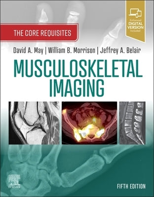 Musculoskeletal Imaging: The Core Requisites by May, David A.