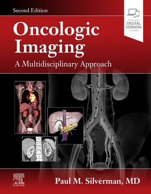 Oncologic Imaging: A Multidisciplinary Approach by Silverman, Paul M.