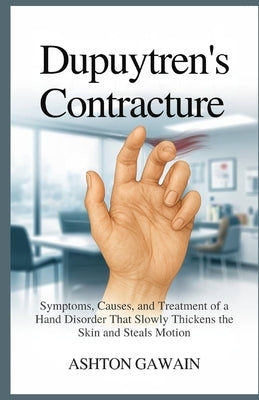 Dupuytren's Contracture: Symptoms, Causes, and Treatment of a Hand Disorder That Slowly Thickens the Skin and Steals Motion by Gawain, Ashton