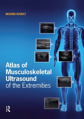 Atlas of Musculoskeletal Ultrasound of the Extremities by Rawat, Mohini