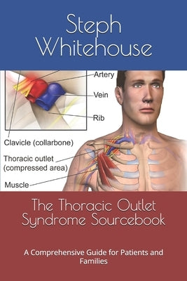 The Thoracic Outlet Syndrome Sourcebook: A Comprehensive Guide for Patients and Families by Whitehouse Mat, Steph E.