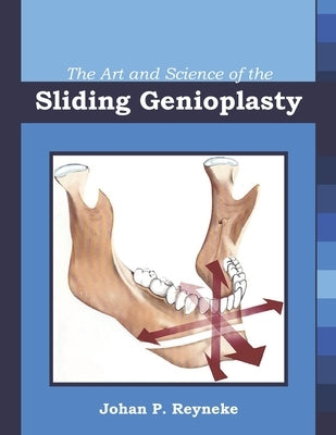 The Art and Science of the Sliding Genioplasty by Reyneke, Johan P.