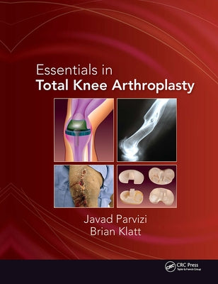 Essentials in Total Knee Arthroplasty by Parvizi, Javad