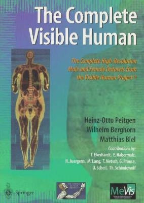 The Complete Visible Human: The Complete High-Resolution Male and Female Anatomical Datasets from the Visible Human Project (Tm) by Peitgen, H. -O