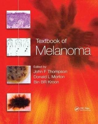 Textbook of Melanoma: Pathology, Diagnosis and Management by Thompson, John F.