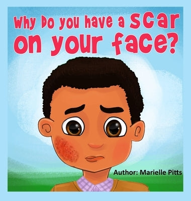 Why do you have a scar on your face? by Pitts, Marielle