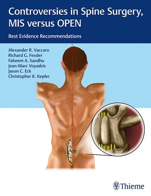 Controversies in Spine Surgery, MIS Versus Open: Best Evidence Recommendations by Vaccaro, Alexander R.
