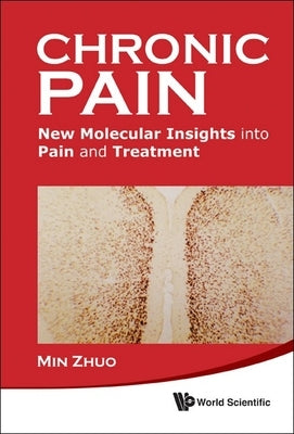 Chronic Pain by Zhuo Min