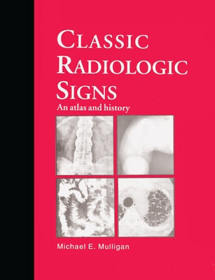 Classic Radiologic Signs: An Atlas and History by Mulligan, M. E.