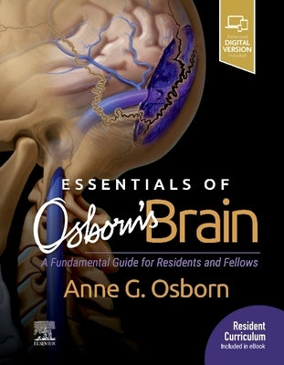 Essentials of Osborn's Brain: A Fundamental Guide for Residents and Fellows by Osborn, Anne G.