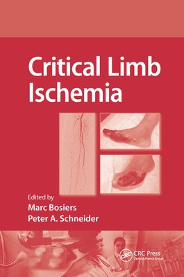 Critical Limb Ischemia by Bosiers, Marc