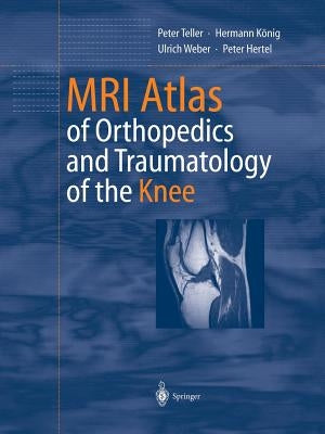 MRI Atlas of Orthopedics and Traumatology of the Knee by Teller, Peter