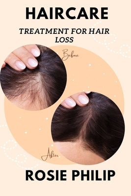 Haircare: Treatment for hair loss by Philip, Rosie