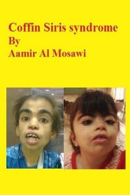 Coffin Siris syndrome: Clinical genetics by Al Mosawi, Aamir Jalal