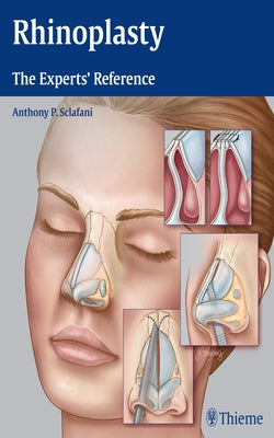 Rhinoplasty: The Experts' Reference by Sclafani, Anthony P.