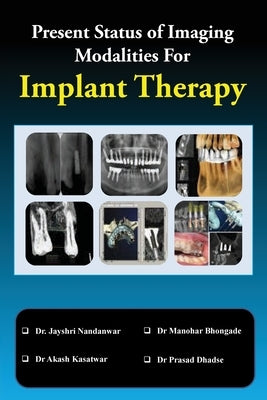 Present Status of Imaging Modalities For Implant Therapy by Nandanwar, Jayshri