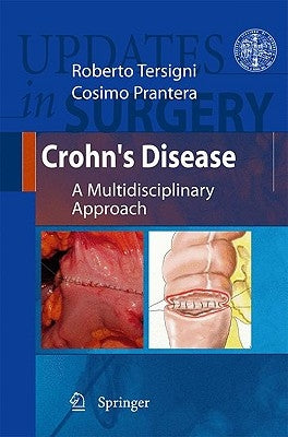 Crohn's Disease: A Multidisciplinary Approach by Tersigni, Roberto