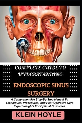 Complete Guide to Understanding Endoscopic Sinus Surgery: A Comprehensive Step-By-Step Manual To Techniques, Procedures, And Post-Operative Care Exper by Hoyle, Klein