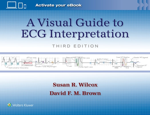 A Visual Guide to ECG Interpretation: Print + eBook with Multimedia by Wilcox, Susan Renee