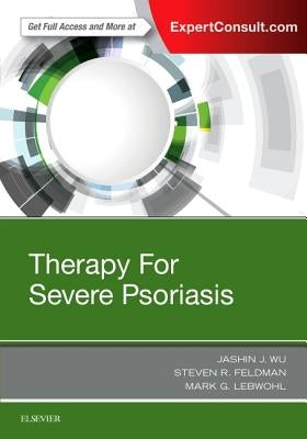 Therapy for Severe Psoriasis by Wu, Jashin J.
