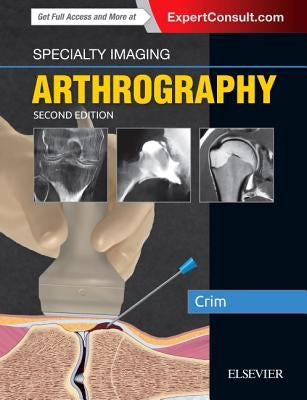 Specialty Imaging: Arthrography by Crim, Julia R.