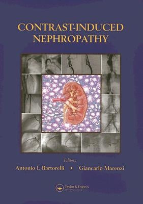 Contrast-Induced Nephropathy in Interventional Cardiovascular Medicine by Bartorelli, Antonio L.