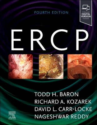 Ercp by Baron, Todd H.