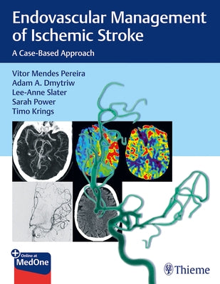 Endovascular Management of Ischemic Stroke: A Case-Based Approach by Pereira, Vitor