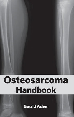 Osteosarcoma Handbook by Asher, Gerald