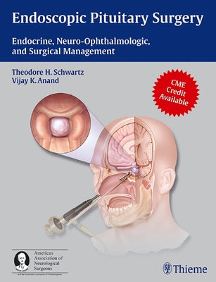 Endoscopic Pituitary Surgery: Endocrine, Neuro-Ophthalmologic, and Surgical Management [With 3-D Glasses] by Schwartz, Theodore H.